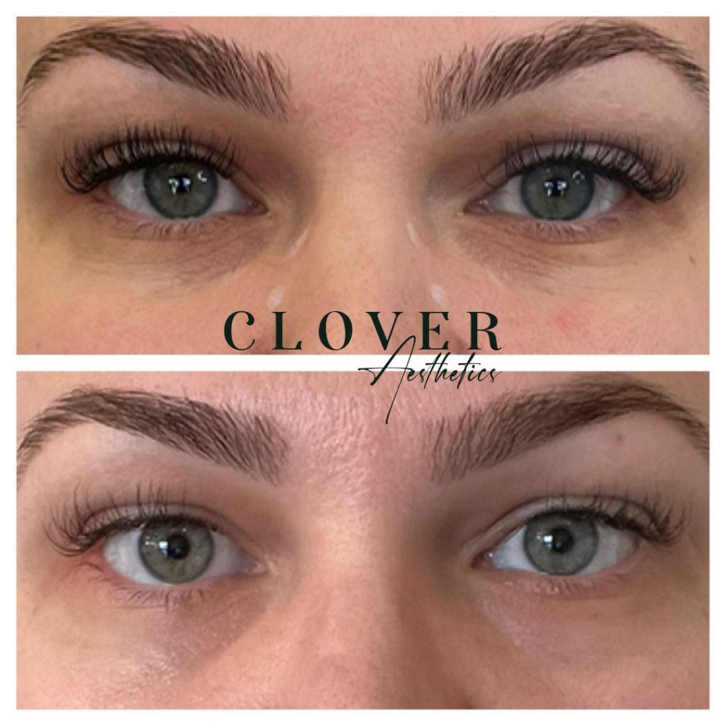 Meet Jennifer Meyer Owner & Nurse Injector SHOUTOUT DFW