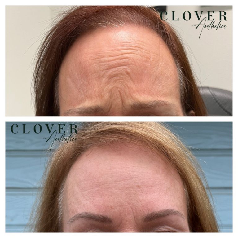 Meet Jennifer Meyer Owner & Nurse Injector SHOUTOUT DFW