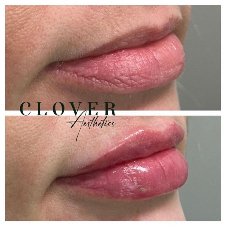 Meet Jennifer Meyer Owner & Nurse Injector SHOUTOUT DFW