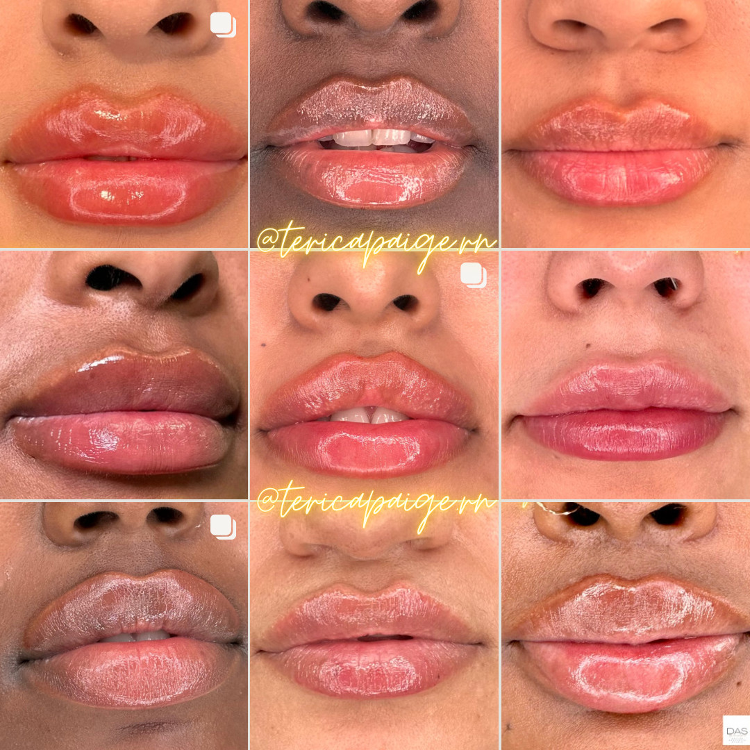 Meet Terica Wright Nurse Injector, BSN RN SHOUTOUT DFW